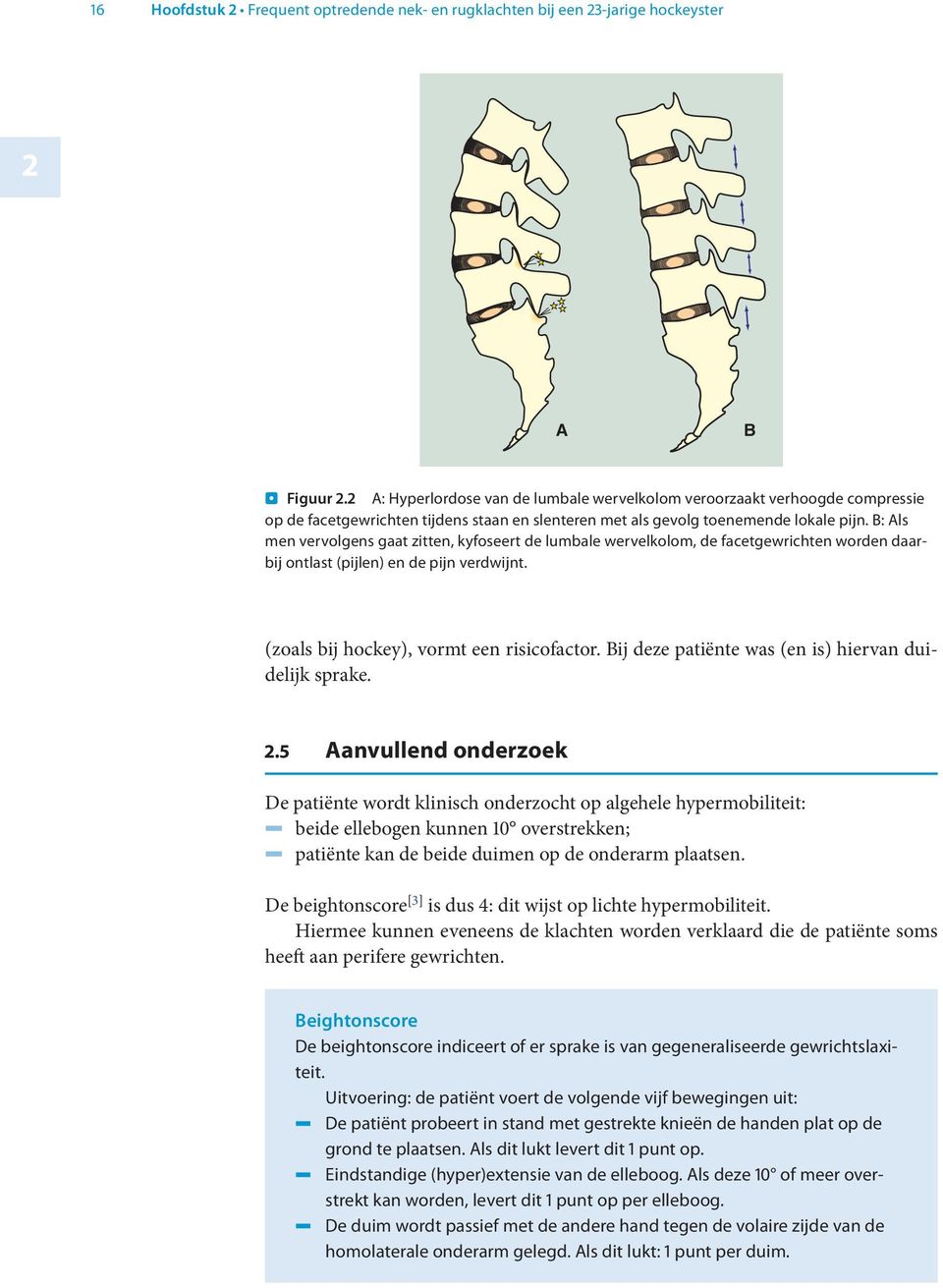 B: Als men vervolgens gaat zitten, kyfoseert de lumbale wervelkolom, de facetgewrichten worden daarbij ontlast (pijlen) en de pijn verdwijnt. (zoals bij hockey), vormt een risicofactor.