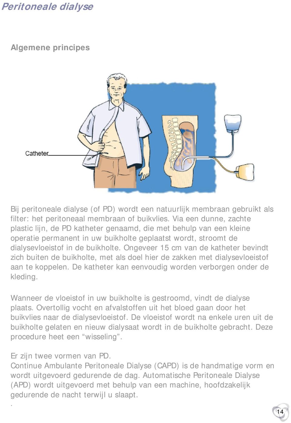 Ongeveer 15 cm van de katheter bevindt zich buiten de buikholte, met als doel hier de zakken met dialysevloeistof aan te koppelen. De katheter kan eenvoudig worden verborgen onder de kleding.