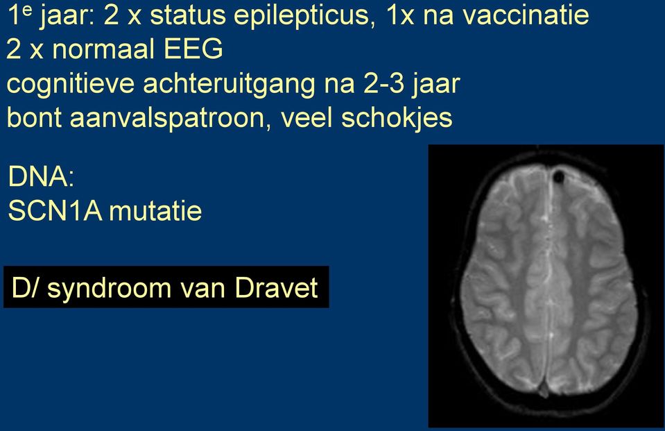 achteruitgang na 2-3 jaar bont