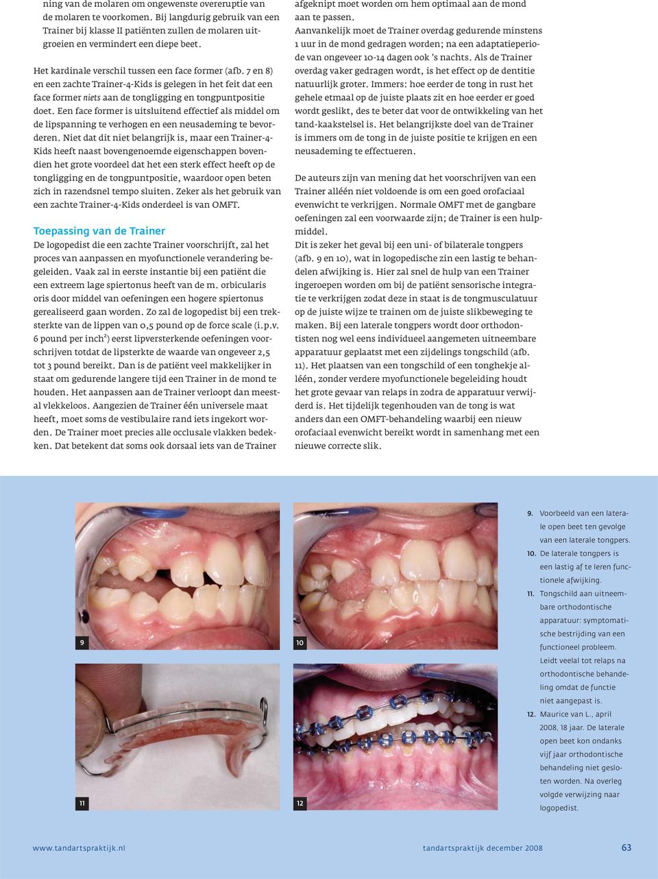 Een face former is uitsluitend effectief als middel om de lipspanning te verhogen en een neusademing te bevorderen.