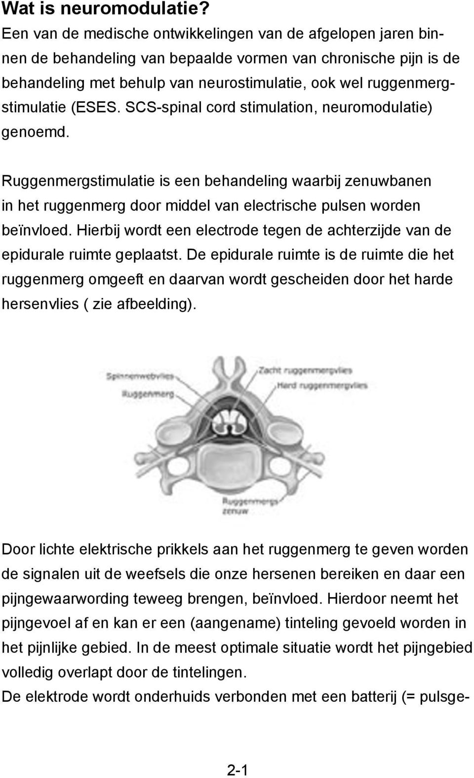 SCS-spinal cord stimulation, neuromodulatie) genoemd. Ruggenmergstimulatie is een behandeling waarbij zenuwbanen in het ruggenmerg door middel van electrische pulsen worden beïnvloed.