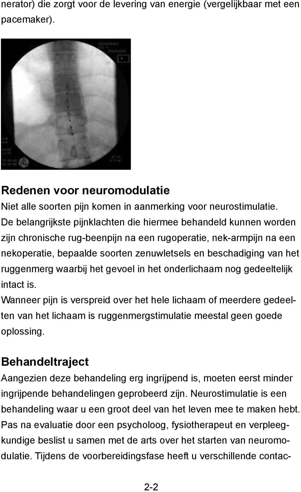 waarbij het gevoel in het onderlichaam nog gedeeltelijk intact is.