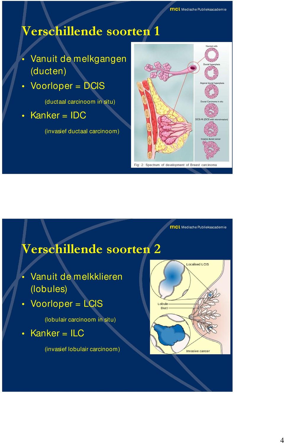 Verschillende soorten 2 Vanuit de melkklieren (lobules) Voorloper =