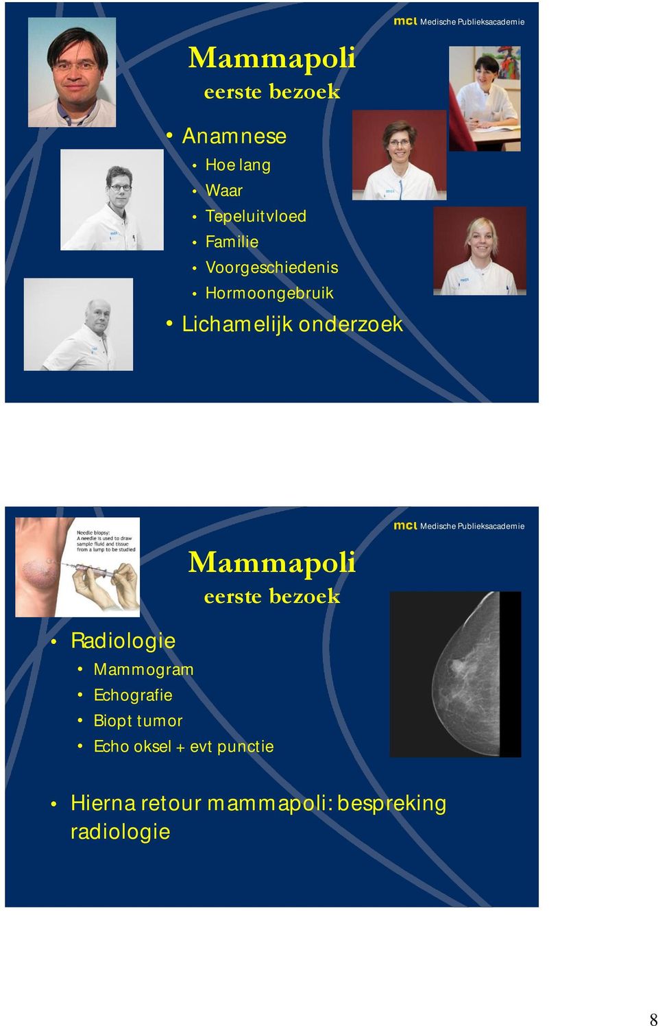 Mammapoli eerste bezoek Radiologie Mammogram Echografie Biopt