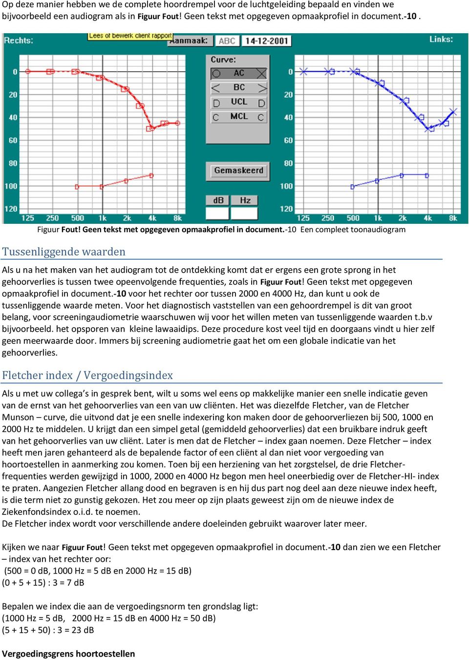 -10 Een compleet toonaudiogram Tussenliggende waarden Als u na het maken van het audiogram tot de ontdekking komt dat er ergens een grote sprong in het gehoorverlies is tussen twee opeenvolgende