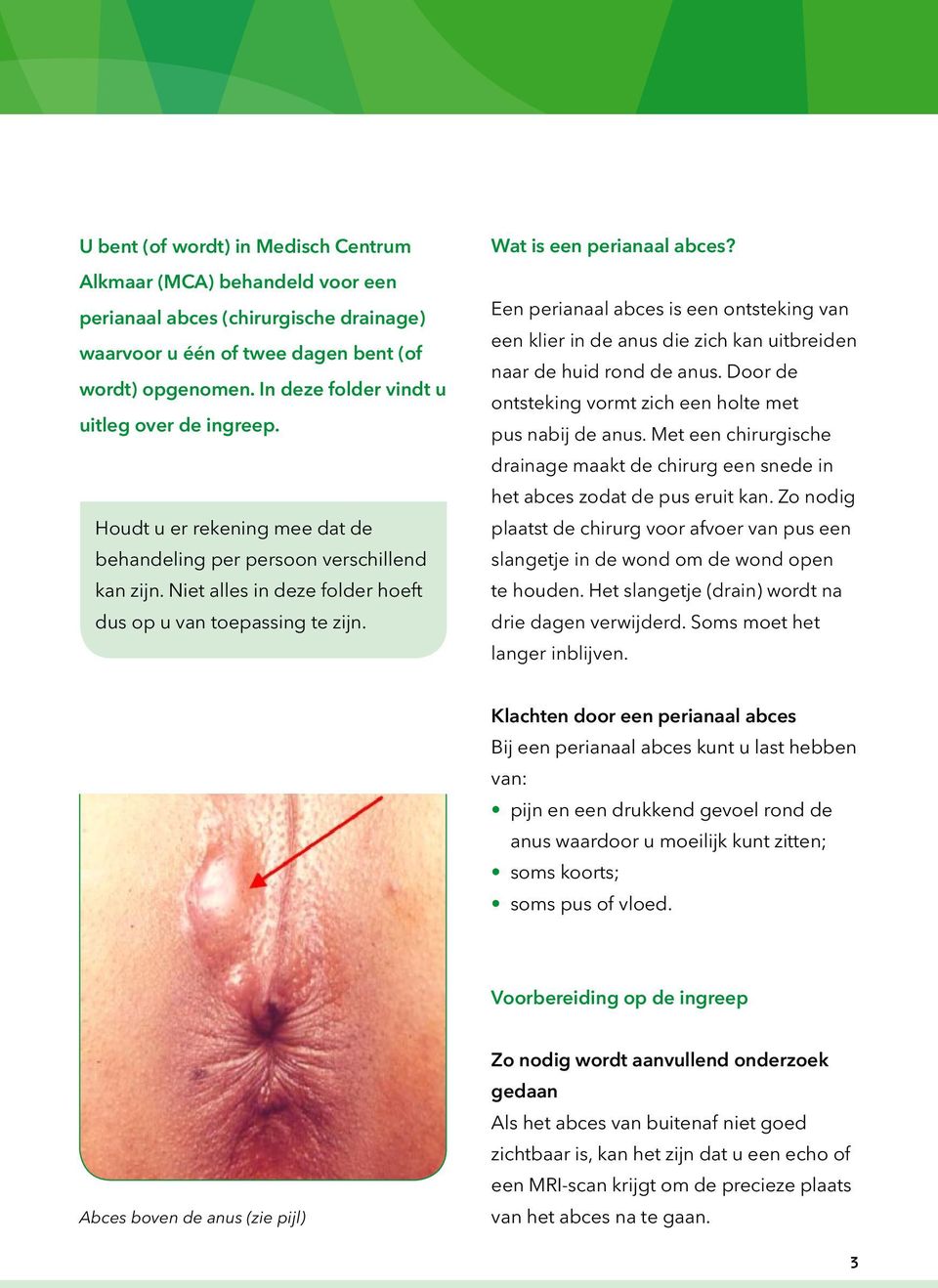 Wat is een perianaal abces? Een perianaal abces is een ontsteking van een klier in de anus die zich kan uitbreiden naar de huid rond de anus.