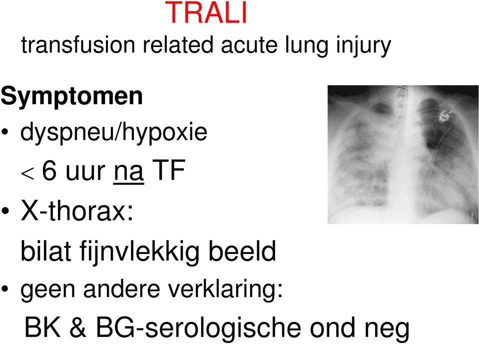 na TF X-thorax: bilat fijnvlekkig beeld