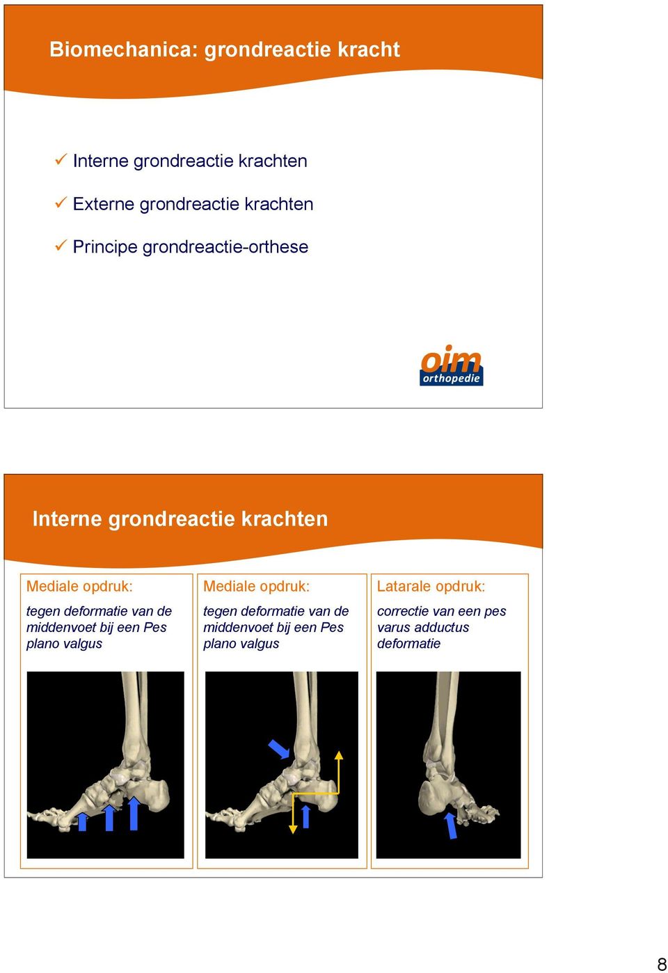 deformatie van de middenvoet bij een Pes plano valgus Mediale opdruk: tegen deformatie van