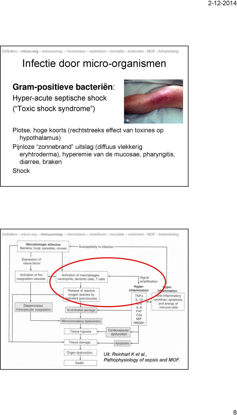 hypothalamus) Pijnloze zonnebrand uitslag (diffuus vlekkerig eryhtroderma), hyperemie van