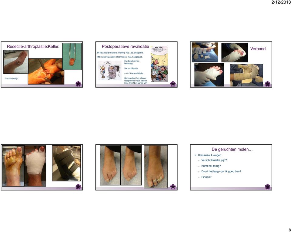 14d: neurovasculaire stoornissen: rust, hoogstand. 3w: beschermde belasting. 5w: mobilisatie.