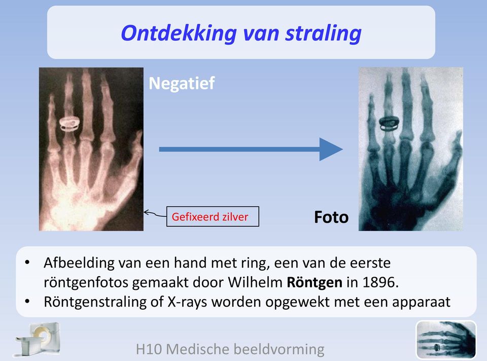 eerste röntgenfotos gemaakt door Wilhelm Röntgen in