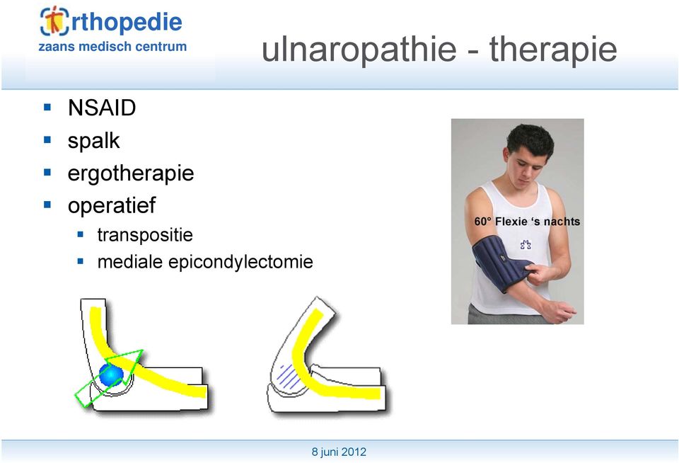 ergotherapie operatief