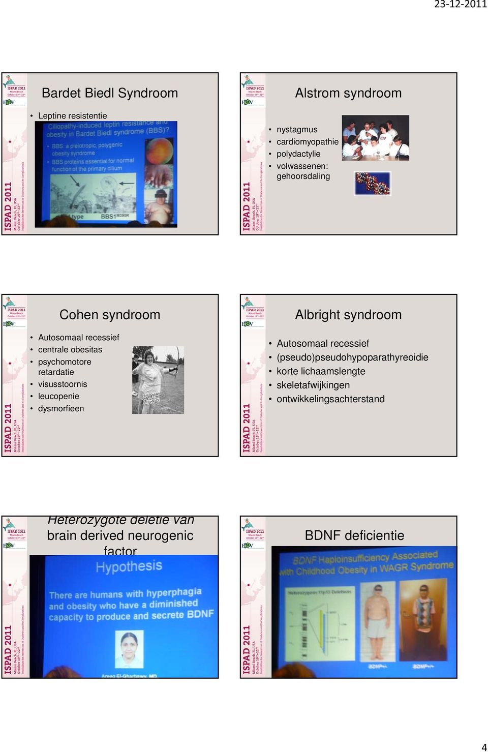 leucopenie dysmorfieen Albright syndroom Autosomaal recessief (pseudo)pseudohypoparathyreoidie korte