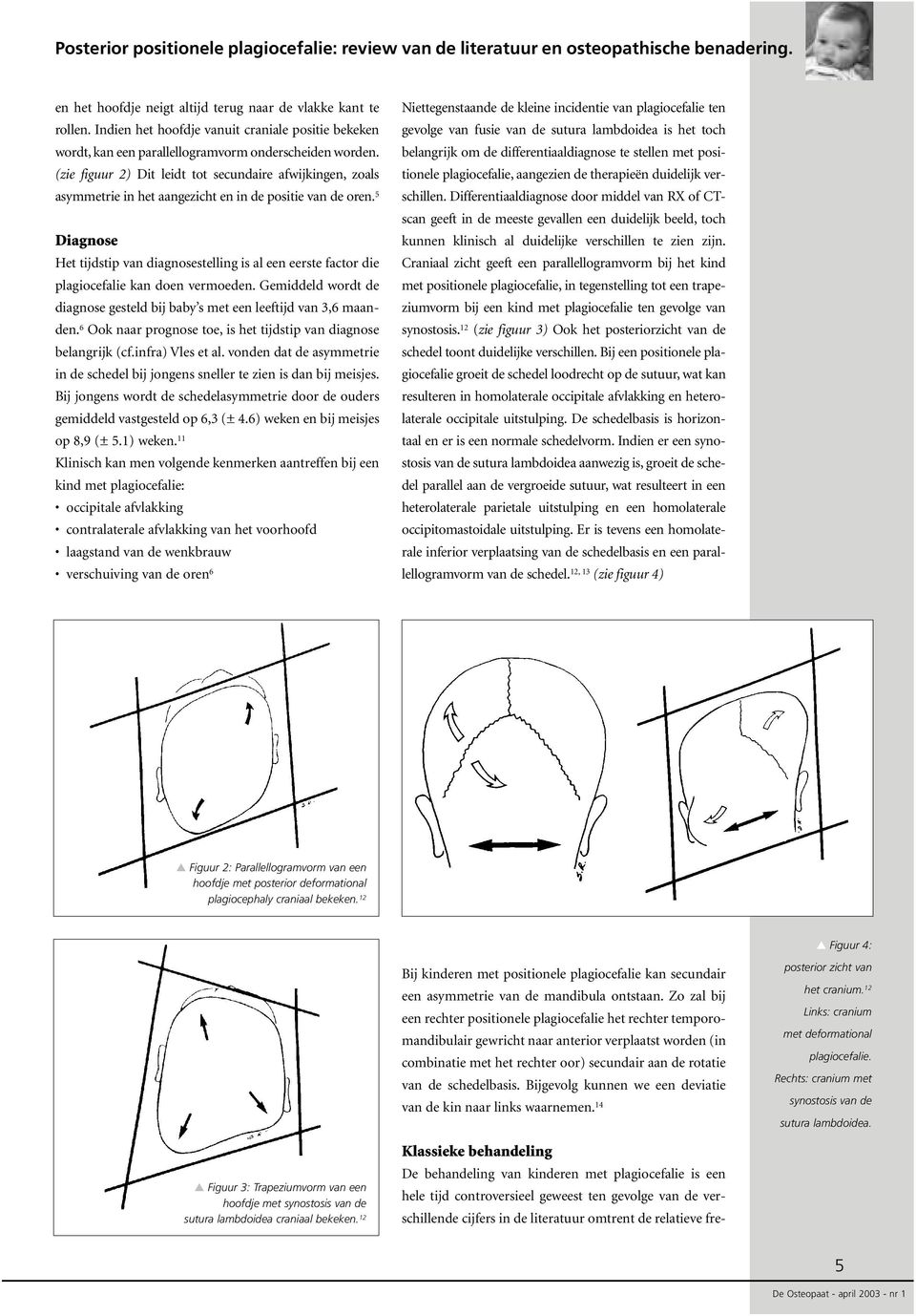 5 Diagnose Het tijdstip van diagnosestelling is al een eerste factor die plagiocefalie kan doen vermoeden. Gemiddeld wordt de diagnose gesteld bij baby s met een leeftijd van 3,6 maanden.