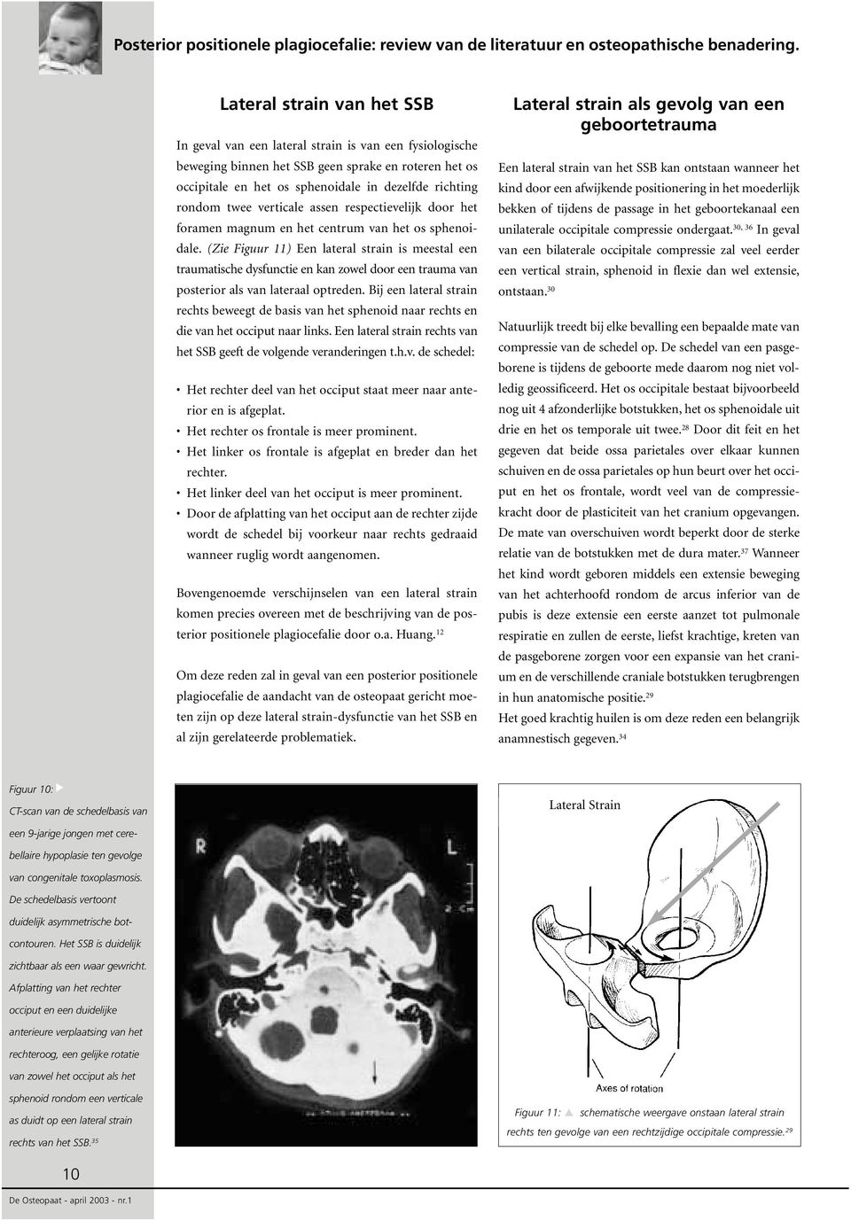 (Zie Figuur 11) Een lateral strain is meestal een traumatische dysfunctie en kan zowel door een trauma van posterior als van lateraal optreden.