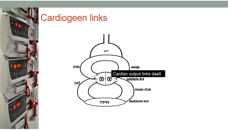 Cardiac