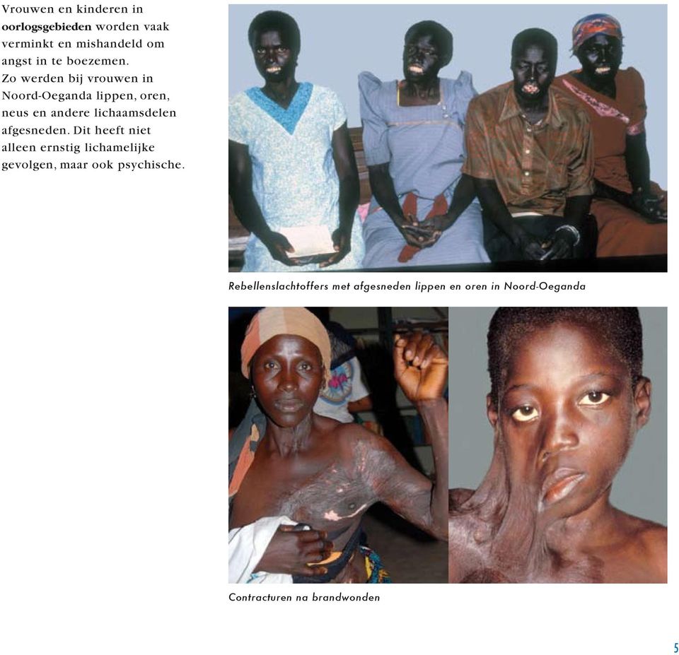 Zo werden bij vrouwen in Noord-Oeganda lippen, oren, neus en andere lichaamsdelen