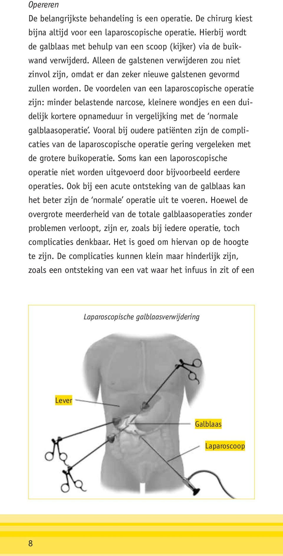 Alleen de galstenen verwijderen zou niet zinvol zijn, omdat er dan zeker nieuwe galstenen gevormd zullen worden.