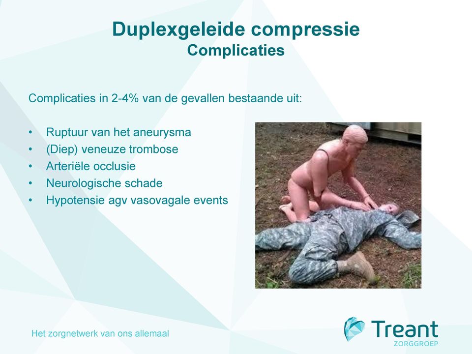 het aneurysma (Diep) veneuze trombose Arteriële