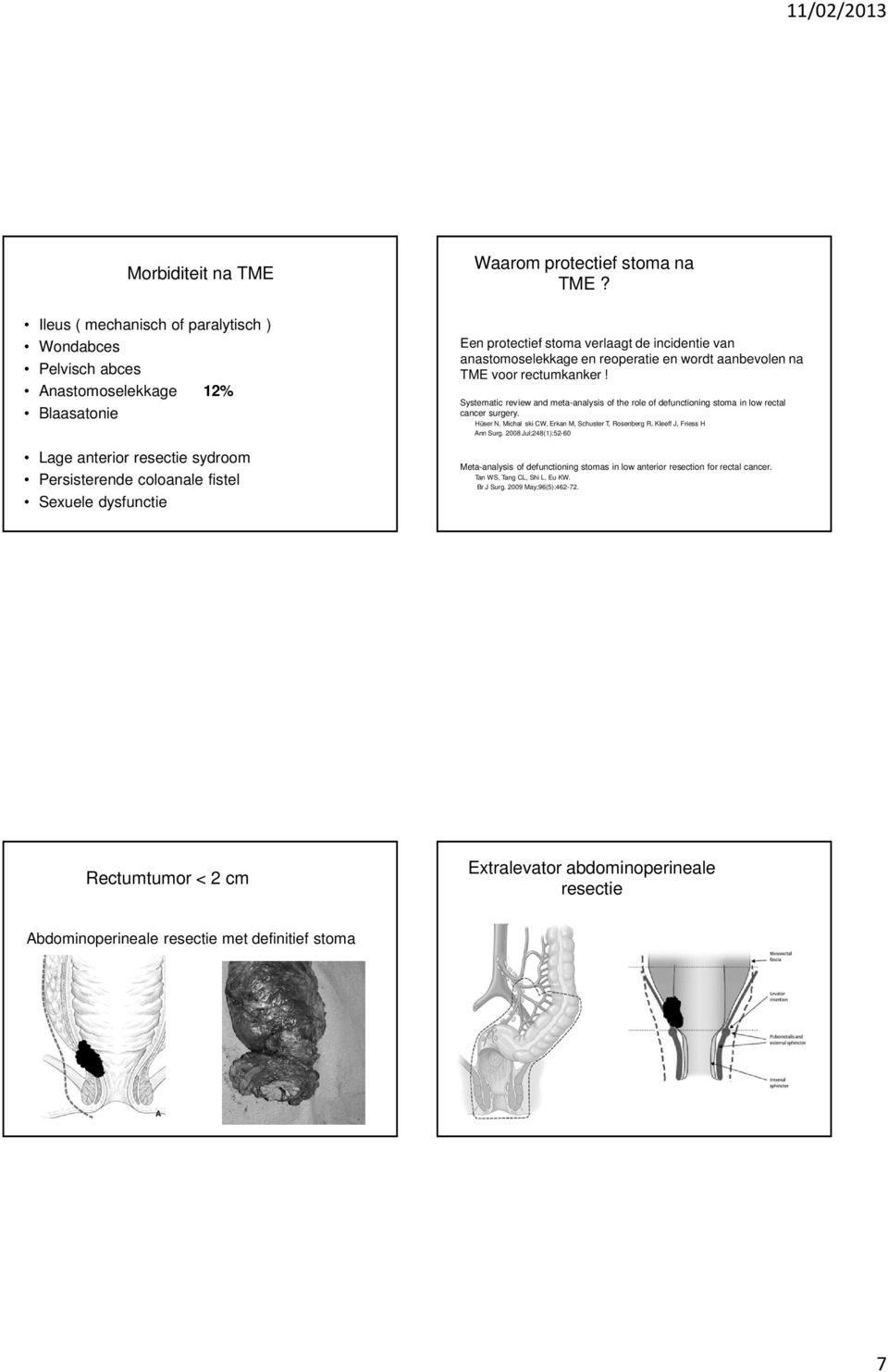 Systematic review and meta-analysis of the role of defunctioning stoma in low rectal cancer surgery. Hüser N, Michal ski CW, Erkan M, Schuster T, Rosenberg R, Kleeff J, Friess H Ann Surg.