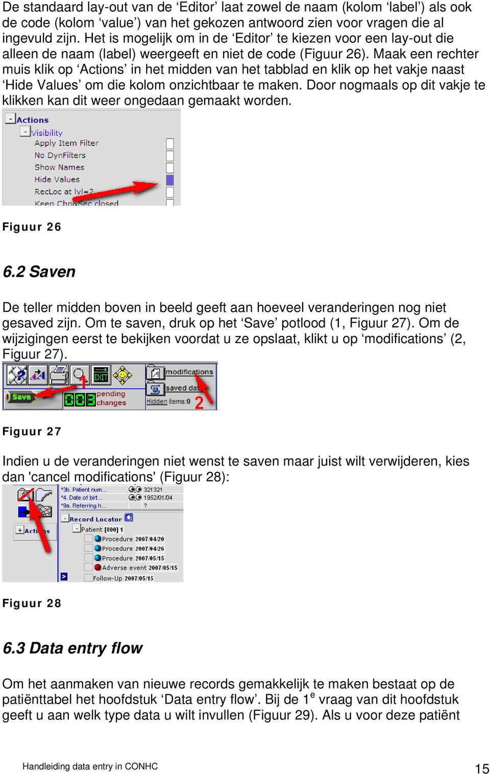 Maak een rechter muis klik op Actions in het midden van het tabblad en klik op het vakje naast Hide Values om die kolom onzichtbaar te maken.