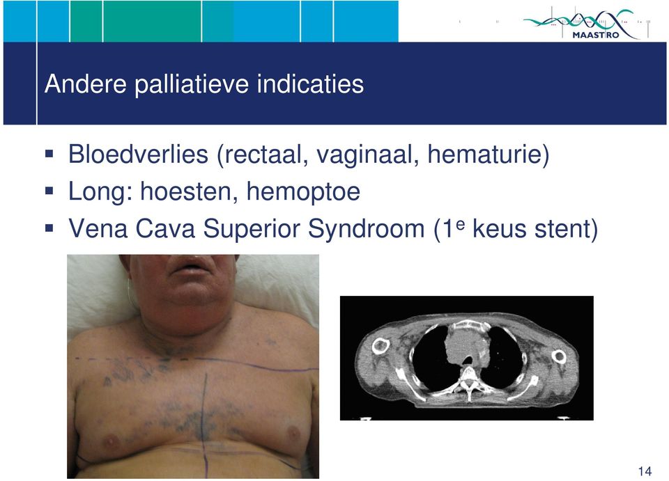 hematurie) Long: hoesten, hemoptoe