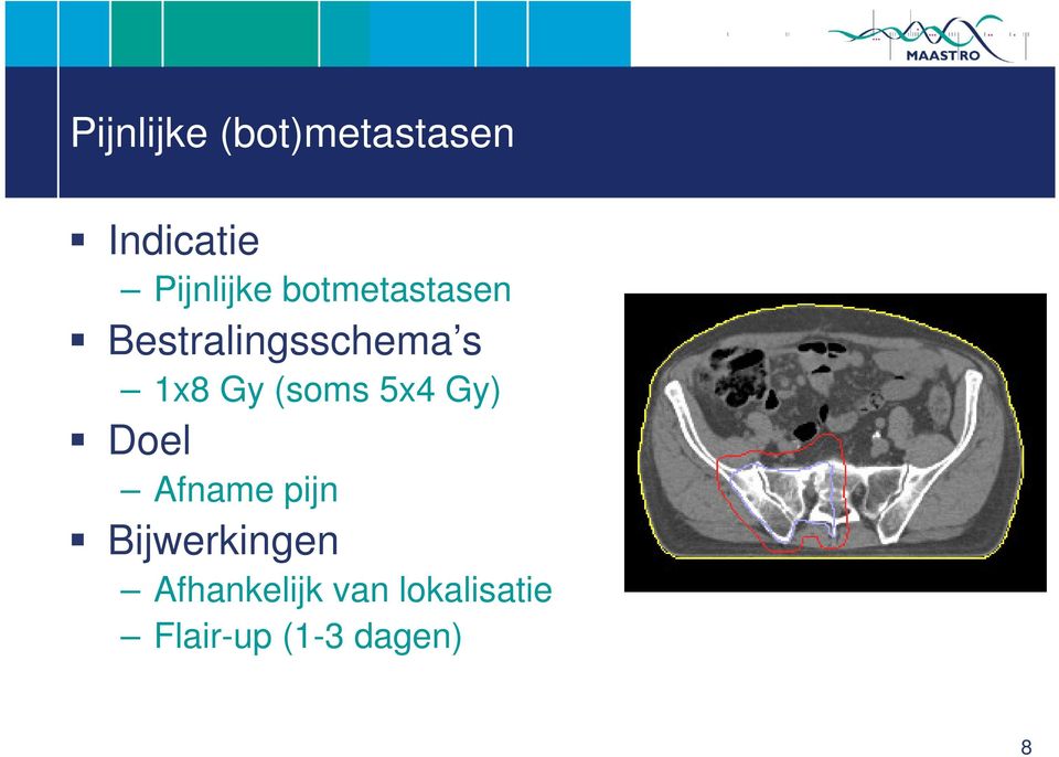 (soms 5x4 Gy) Doel Afname pijn Bijwerkingen