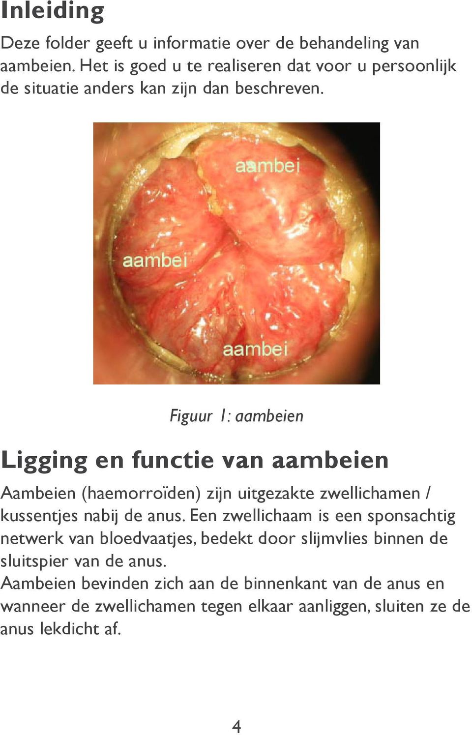 Figuur 1: aambeien Ligging en functie van aambeien Aambeien (haemorroïden) zijn uitgezakte zwellichamen / kussentjes nabij de anus.