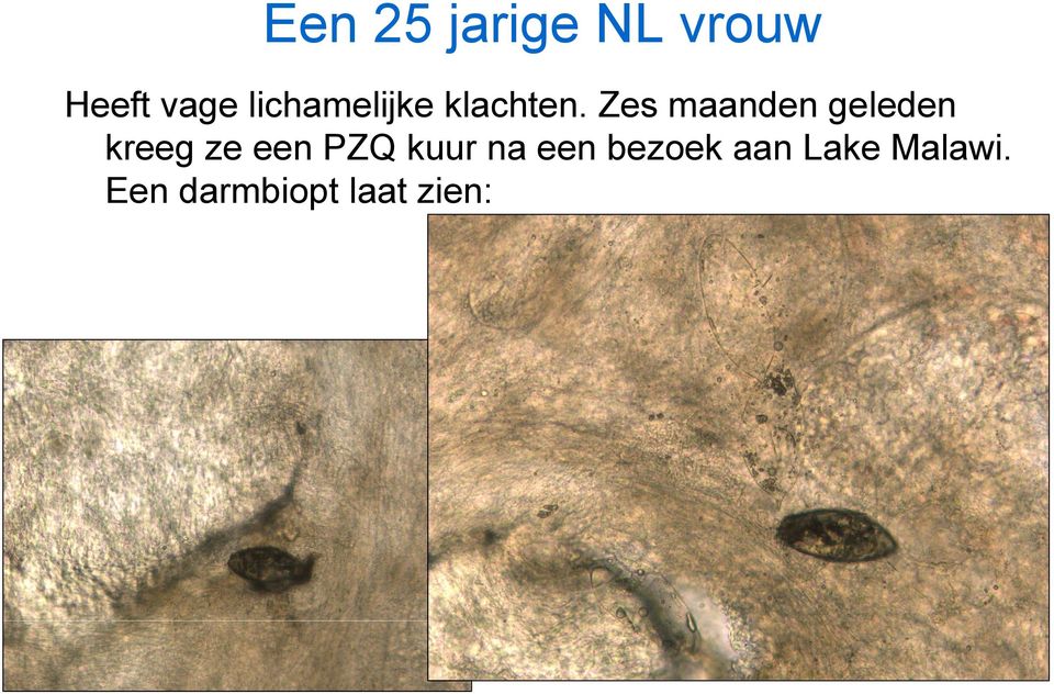 Zes maanden geleden kreeg ze een PZQ