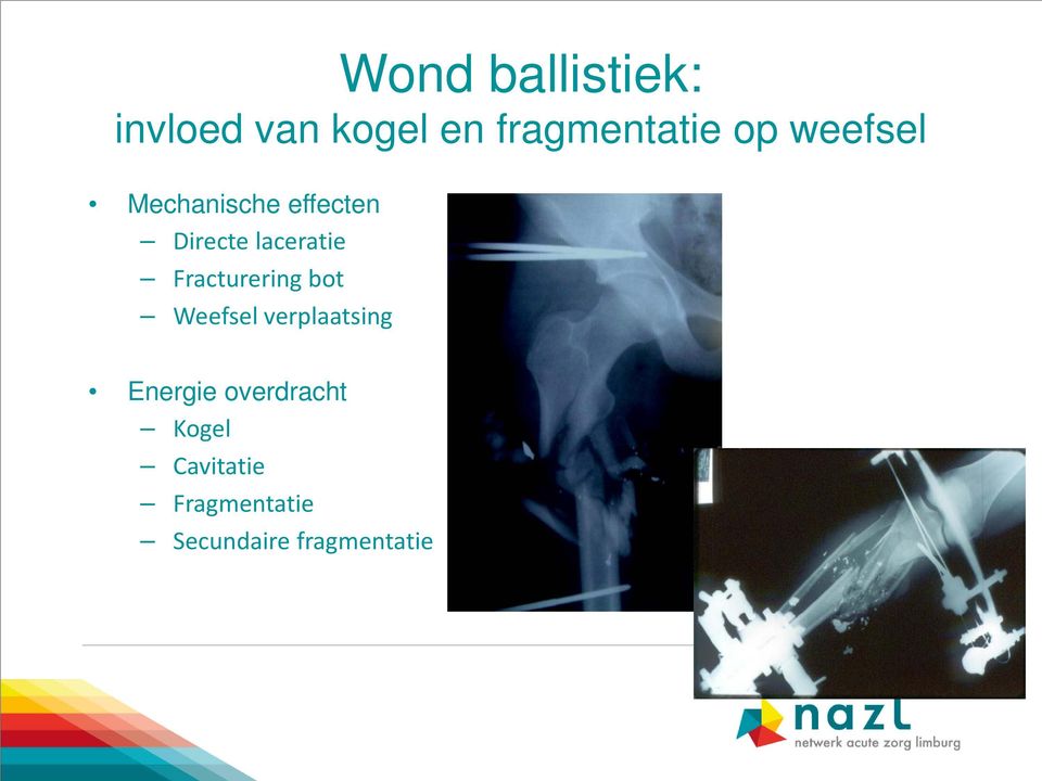 Fracturering bot Weefsel verplaatsing Energie