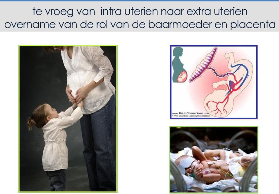 uterien overname van de