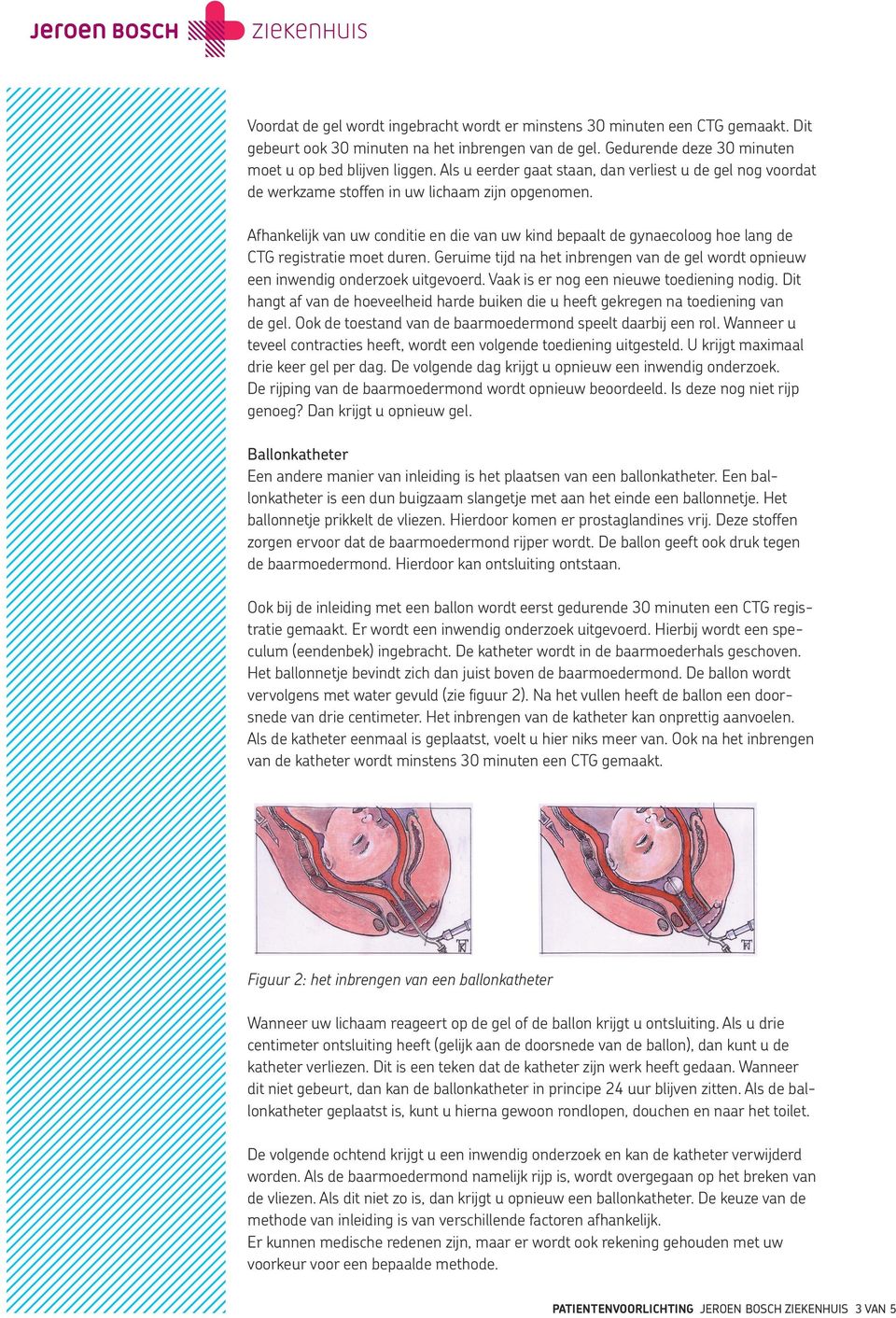 Inleiden van de bevalling - PDF Gratis download