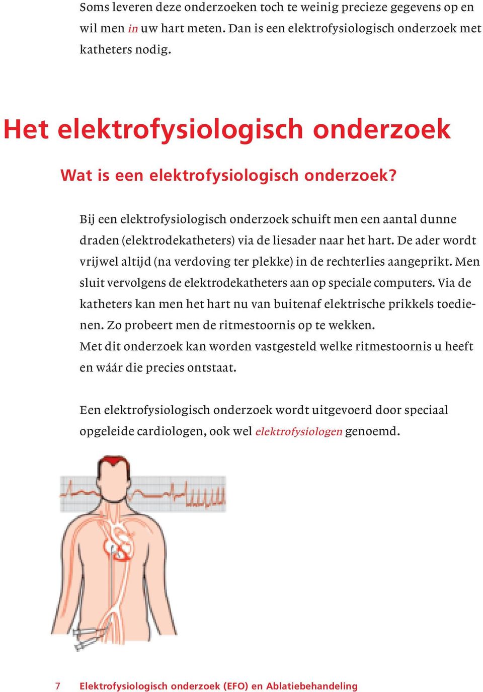 Bij een elektrofysiologisch onderzoek schuift men een aantal dunne draden (elektrodekatheters) via de liesader naar het hart.
