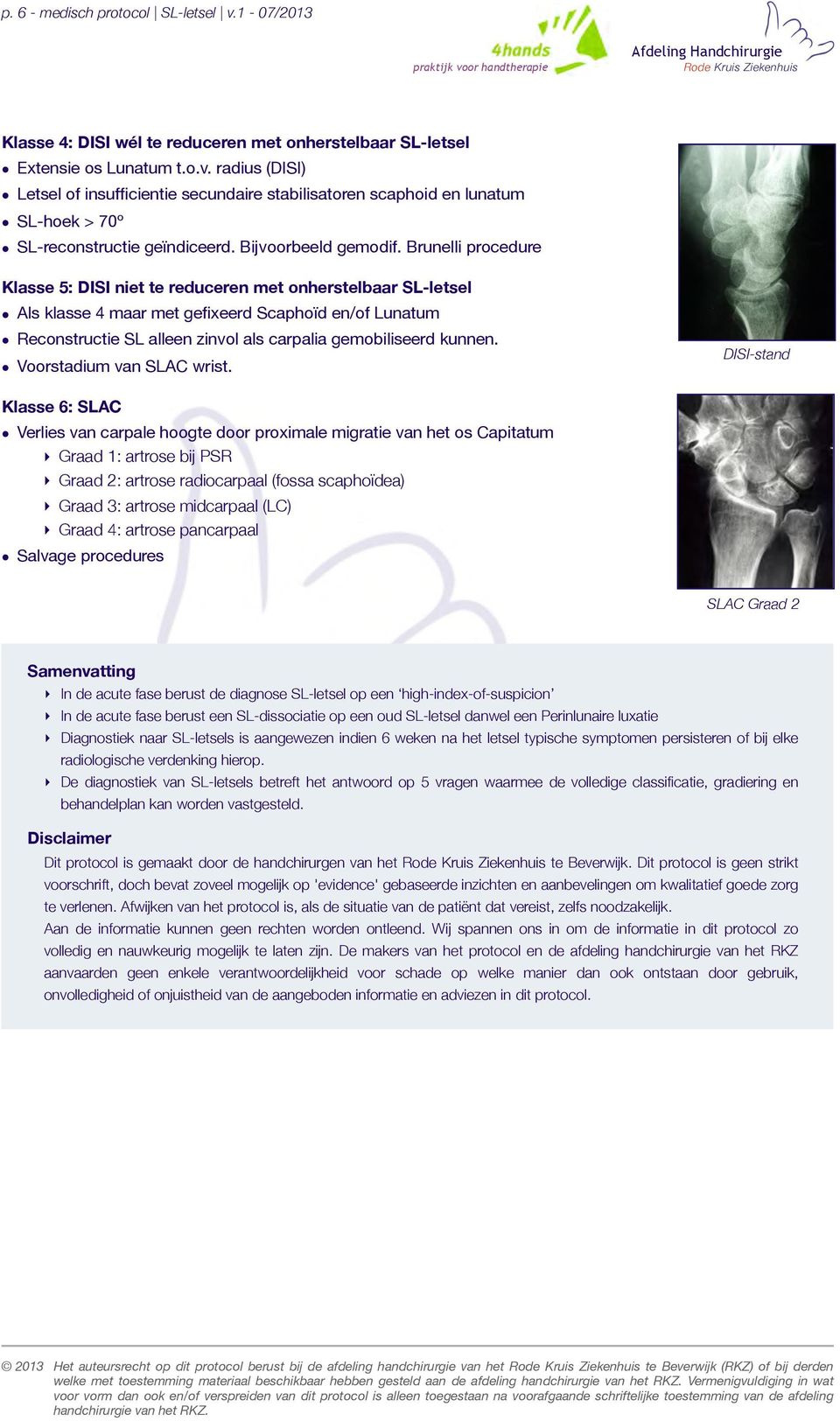 Brunelli procedure Klasse 5: DISI niet te reduceren met onherstelbaar SL-letsel Als klasse 4 maar met gefixeerd Scaphoïd en/of Lunatum Reconstructie SL alleen zinvol als carpalia gemobiliseerd kunnen.