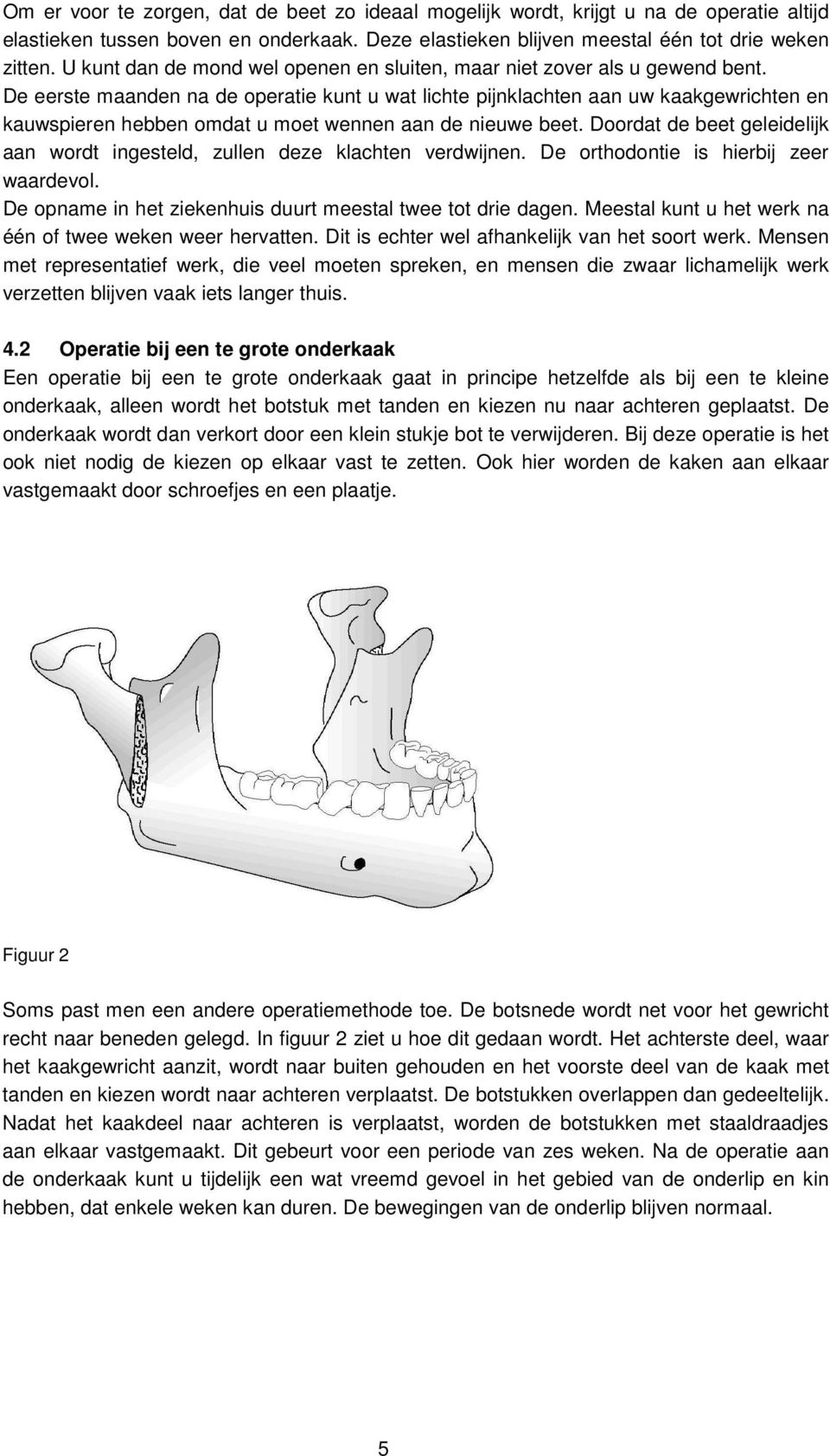 De eerste maanden na de operatie kunt u wat lichte pijnklachten aan uw kaakgewrichten en kauwspieren hebben omdat u moet wennen aan de nieuwe beet.