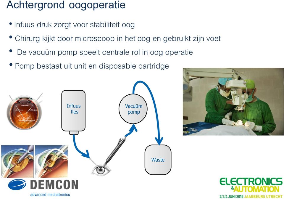 De vacuüm pomp speelt centrale rol in oog operatie Pomp