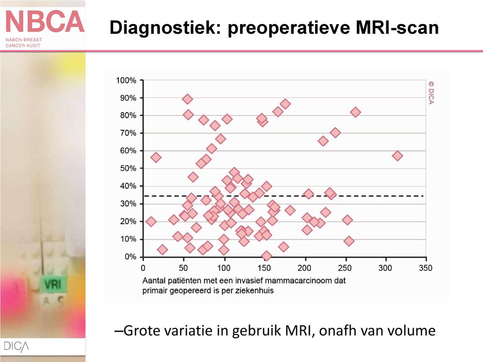 MRI-scan Grote