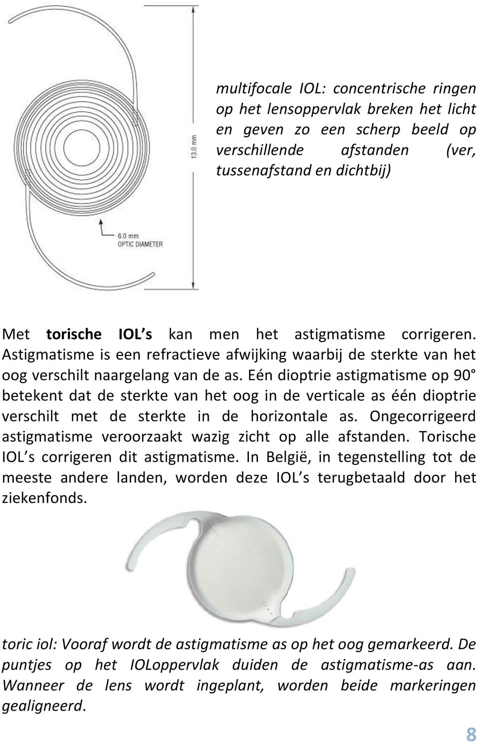 Eén dioptrie astigmatisme op 90 betekent dat de sterkte van het oog in de verticale as één dioptrie verschilt met de sterkte in de horizontale as.