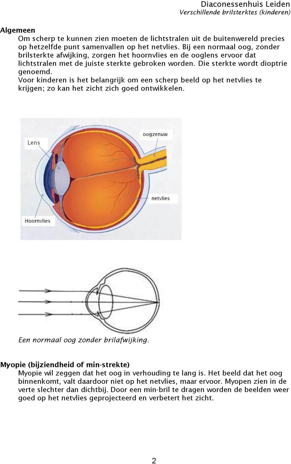 Voor kinderen is het belangrijk om een scherp beeld op het netvlies te krijgen; zo kan het zicht zich goed ontwikkelen. Een normaal oog zonder brilafwijking.