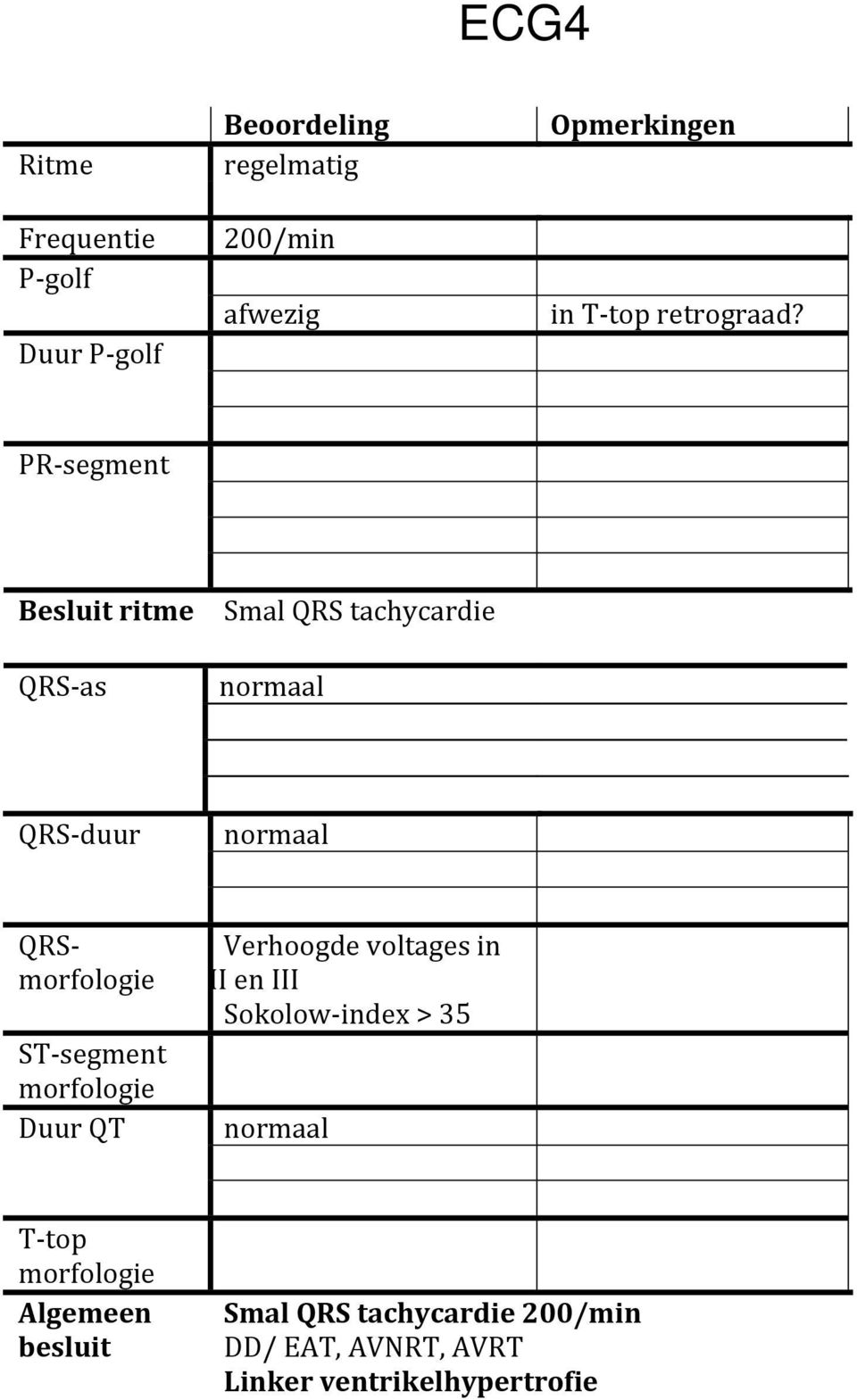 PR- segment Besluit ritme QRS- as Smal QRS tachycardie QRS- duur QRS- ST- segment Duur QT