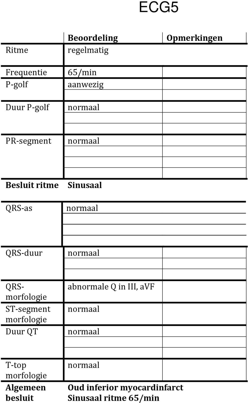Sinusaal QRS- duur QRS- ST- segment Duur QT abnormale Q in III, avf