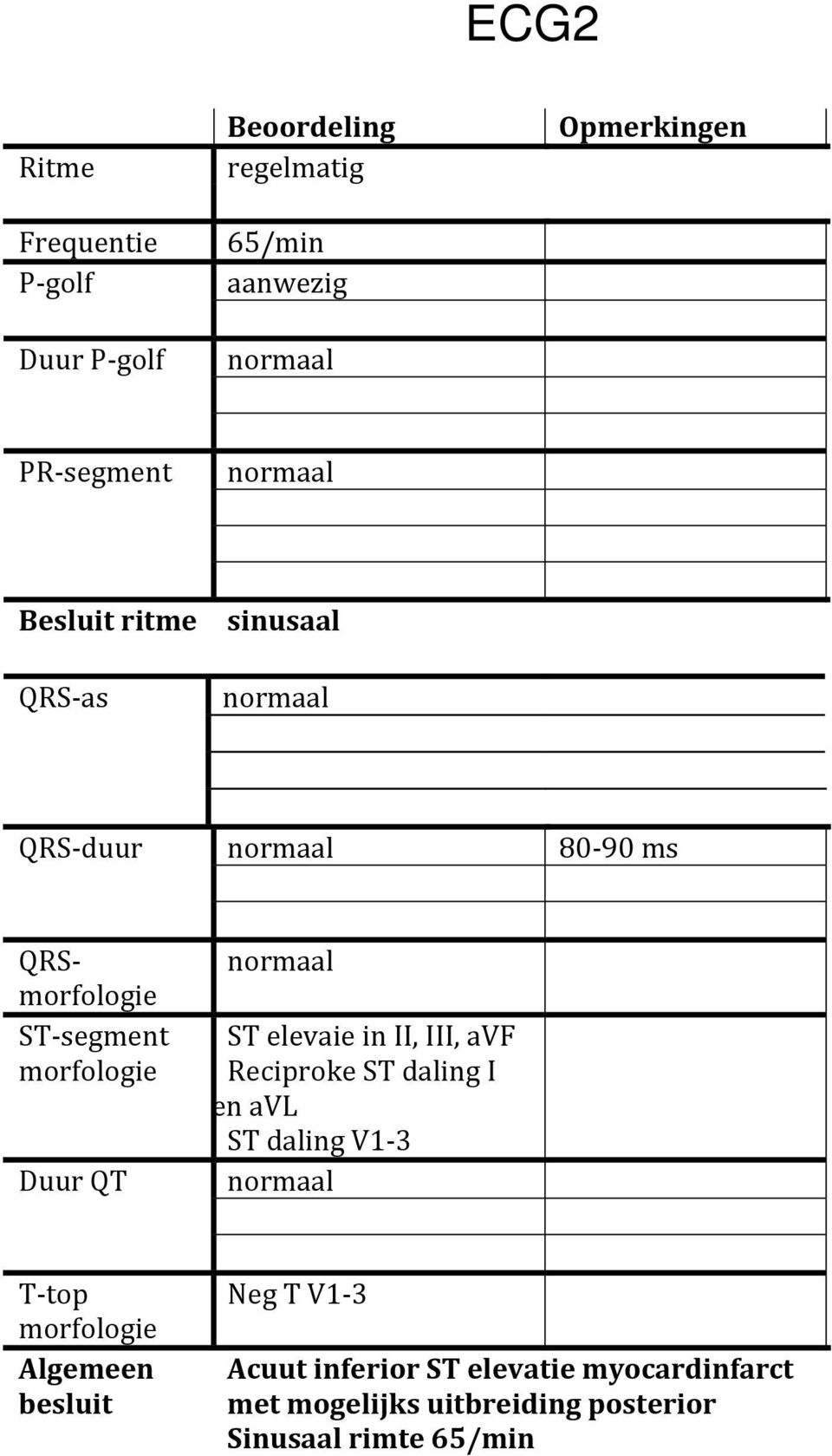 elevaie in II, III, avf Reciproke ST daling I en avl ST daling V1-3 T- top Algemeen besluit Neg