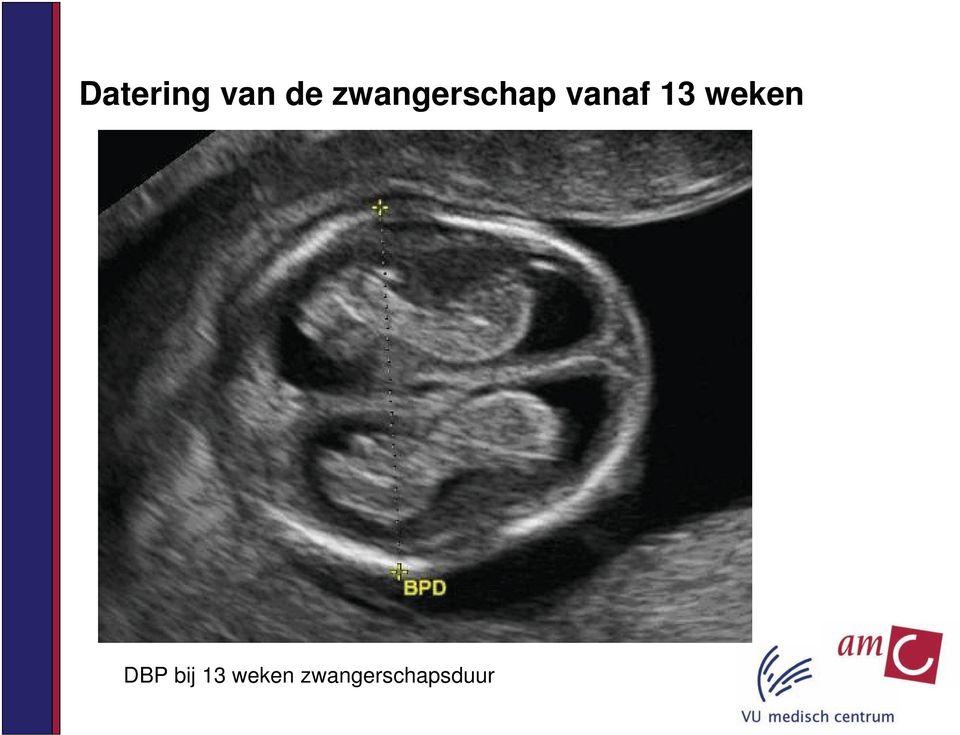 13 weken DBP bij 13