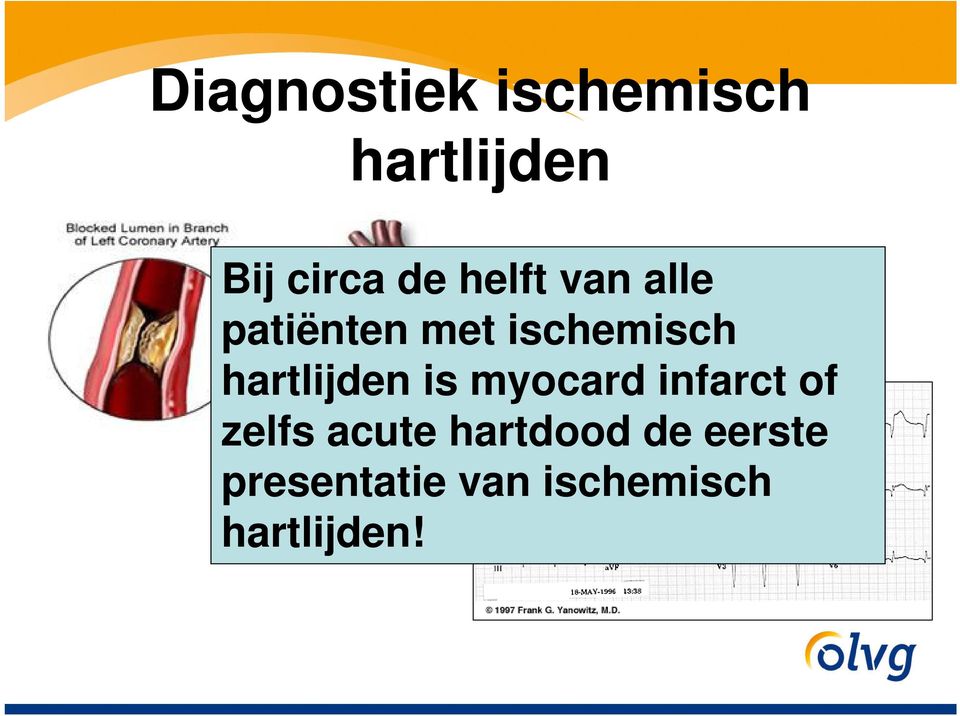 hartlijden is myocard infarct of zelfs acute