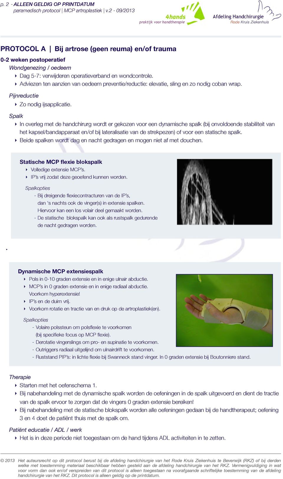 In overleg met de handchirurg wordt er gekozen voor een dynamische spalk (bij onvoldoende stabiliteit van het kapsel/bandapparaat en/of bij lateralisatie van de strekpezen) of voor een statische