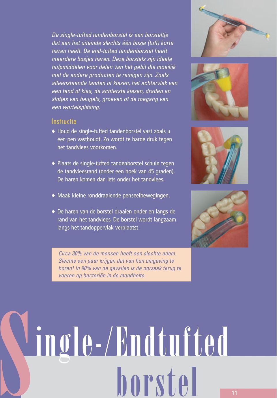 Zoals alleenstaande tanden of kiezen, het achtervlak van een tand of kies, de achterste kiezen, draden en slotjes van beugels, groeven of de toegang van een wortelsplitsing.