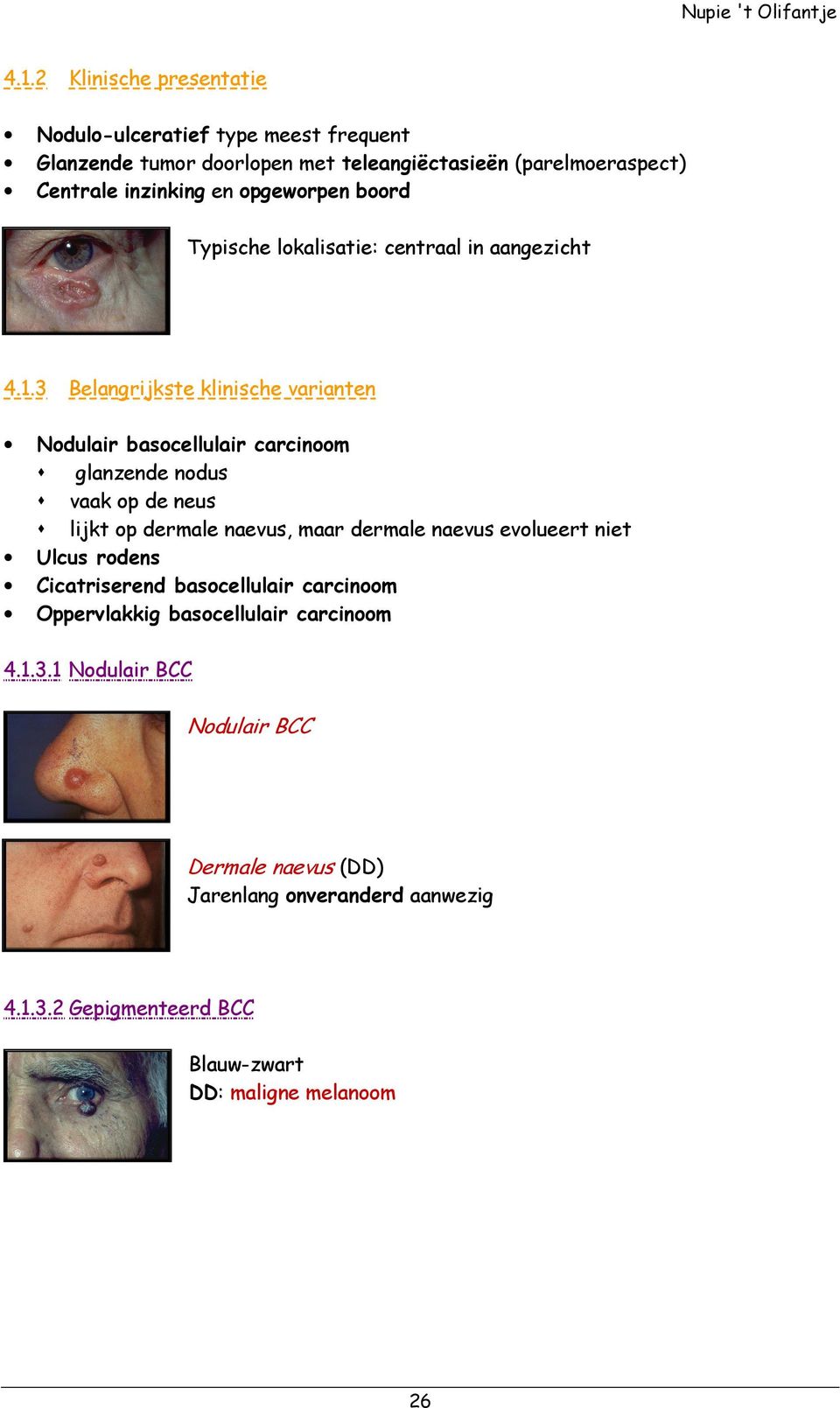 3 Belangrijkste klinische varianten Nodulair basocellulair carcinoom glanzende nodus vaak op de neus lijkt op dermale naevus, maar dermale naevus