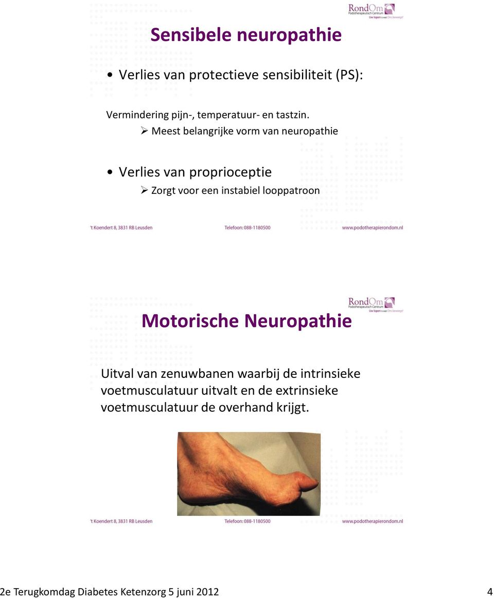 Meest belangrijke vorm van neuropathie Verlies van proprioceptie Zorgt voor een instabiel looppatroon