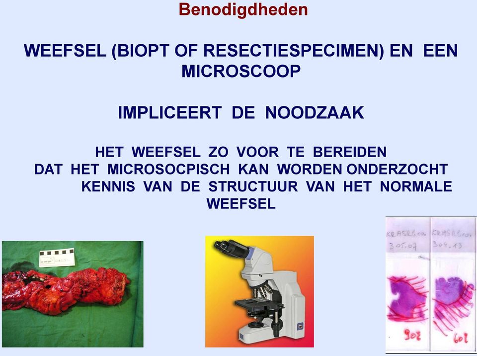 VOOR TE BEREIDEN DAT HET MICROSOCPISCH KAN WORDEN