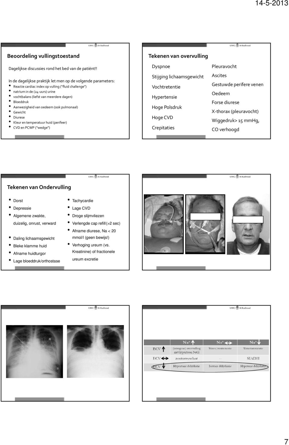 Aanwezigheid van oedeem (ook pulmonaal) Gewicht Diurese Kleur en temperatuur huid (perifeer) CVD en PCWP ( wedge ) Tekenen van overvulling Dyspnoe Stijging lichaamsgewicht Vochtretentie Hypertensie